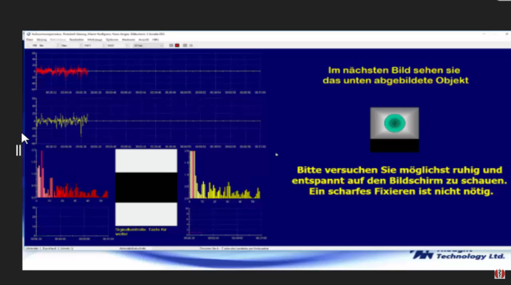 Webcast 19-11 Bio-/Neurofeedback - "Mini-QEEG - Neurofeedback-Analyse Prä-/Post-Training"
