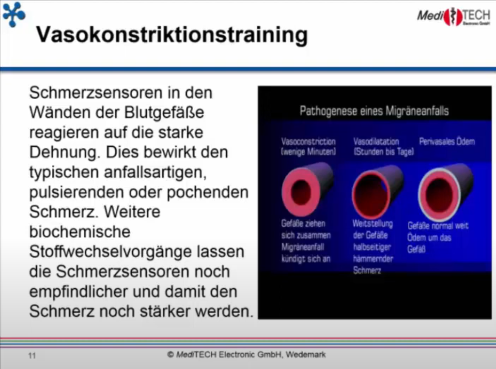 Webcast 19-04 Bio-/Neurofeedback - "Migräne inkl. Vasokonstriktion"