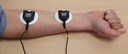 MyoScan EMG-Sensor