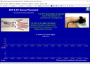 REPETITIVE STRAIN INJURY (RSI) SUITE [BFE]