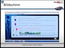 Webcast 19-05 Bio-/Neurofeedback - "Gleichgewicht und Bewegungsrehabilitation"