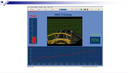 Webcast 21-02 Bio- & Neurofeedback - "HEG bei nicht sprechenden Patienten zur Verbesserung der Kommunikation"