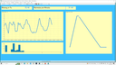 Biofeedback Themenkurs - Biofeedback bei Kindern: Spezialbereich Psychosomatik