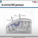 Webcast 19-08 (Bio-/Neurofeedback - "HEG-basiertes Neurofeedback"