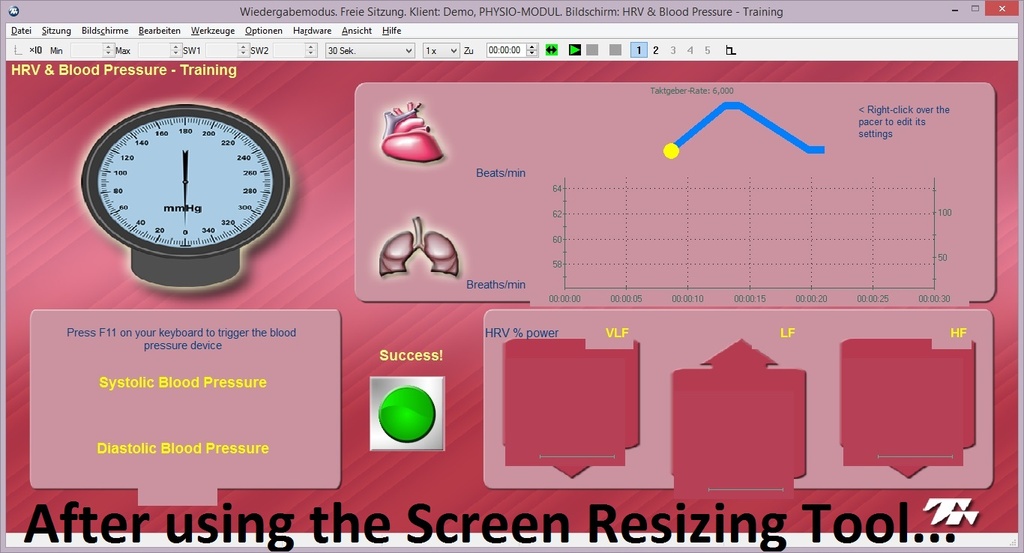 Screen Resizing Tool 05