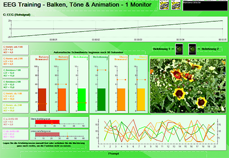 Neuro_Modul EEG Training - Balken