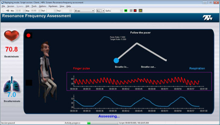 Herzraten-Variabilität (HRV) &quot;Heartrate Variability&quot; Suite für ProComp2 [TTL]