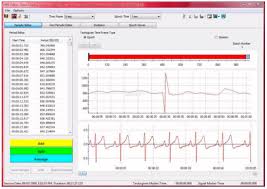 CardioPro Infiniti Software - HRV-Analysesoftware