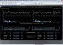 EEG Suite 6.x DE für [P2|P5|PI]