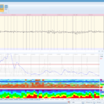 21-Kanal Mitsar-EEG-BT Lite QEEG Edition