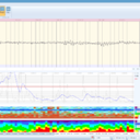 21-Kanal Mitsar-EEG-BT Lite QEEG Edition