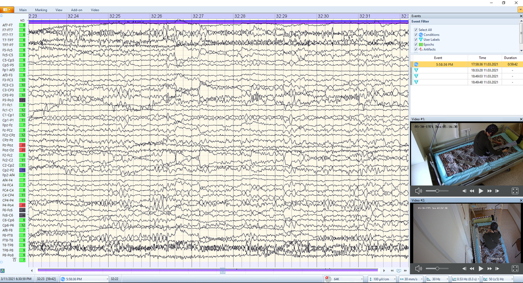 21-Kanal Mitsar-EEG-BT Lite QEEG Edition