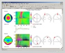WinEEG-Software Mitsar / Fortgeschritten