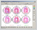 WinEEG-Software Mitsar / Fortgeschritten
