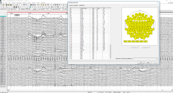 WinEEG-Software Mitsar / Fortgeschritten