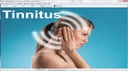 Tinnitus