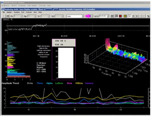 Low Frequency Neurofeedback - Suite [BFE]