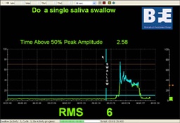 [13016] DYSPHAGIA SUITE &amp;  ONLINE CLASS RECORDING [BFE]