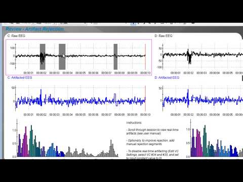 42 - EEG-Artefakte ausschließen