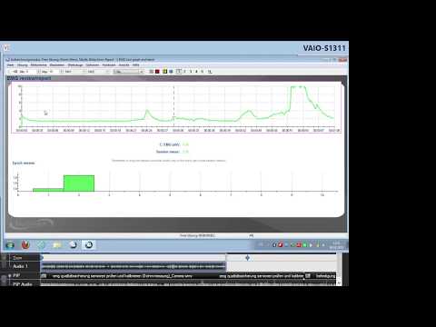 21 - EKG Einstreuung in EMG-Signal